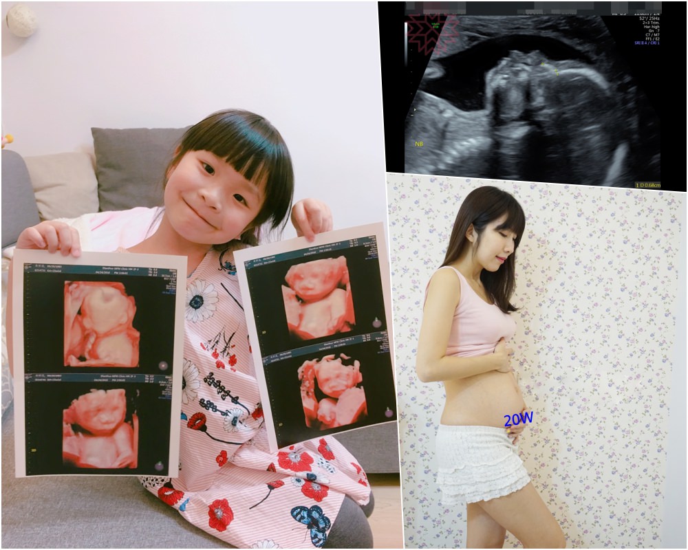 【懷孕】懷孕5~6個月 禾馨高層次超音波 ♥ 小波特全身健檢&真面目
